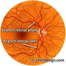 Retinal vasculature drawing