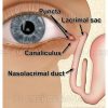 Lacrimal system diagram including lacrimal sac, nasolacrimal duct, punctum and canaliculus