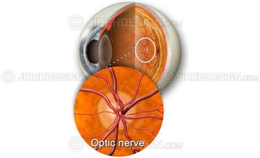 Optic nerve head illustration inset on eye cross-section backdrop #an0038