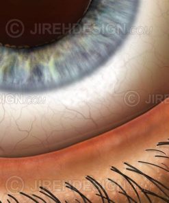 Eyelid margin closeup with lid margin, lashes, conjunctiva, and iris