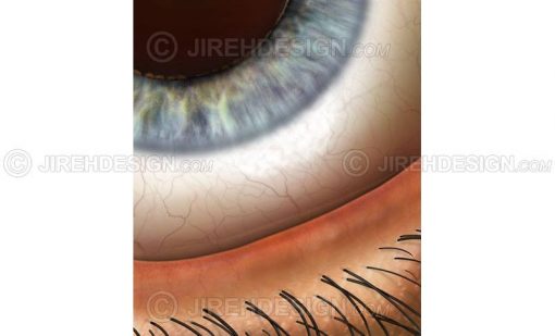 Eyelid margin closeup with lid margin, lashes, conjunctiva, and iris