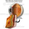 Wet macular degeneration schematic