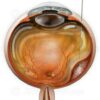 Surgical subretinal injection for treatment of wet macular degeneration.