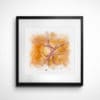 Glaucoma Nerve Watercolor framed