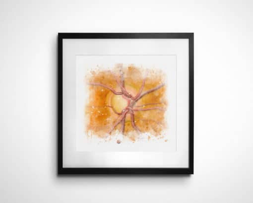 Glaucoma Nerve Watercolor framed