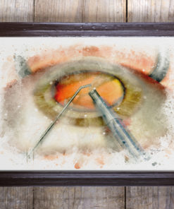 Cataract surgery framed art on wall eye doctor gift