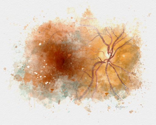 Retina watercolor art print retina doctor gift